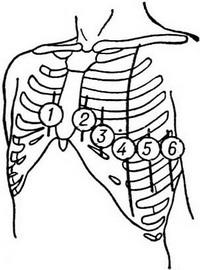 Электрокардиография (ЭКГ)
