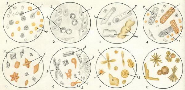 Осадки мочи под микроскопом в картинках