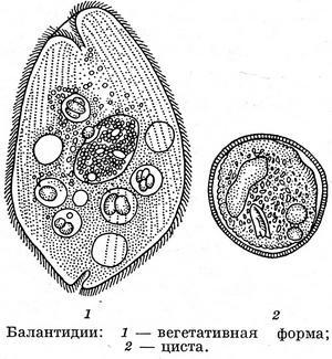 балантидии