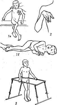 гимнастика при детском церебральном параличе
