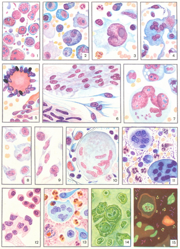 cytological diagnosis