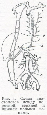 Венозные анастомозы рисунок