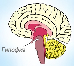 Пролактинома доброкачественная опухоль гипофиза