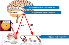 Гипогонадизм