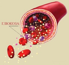 Гипергликемия повышенное содержание в крови глюкозы